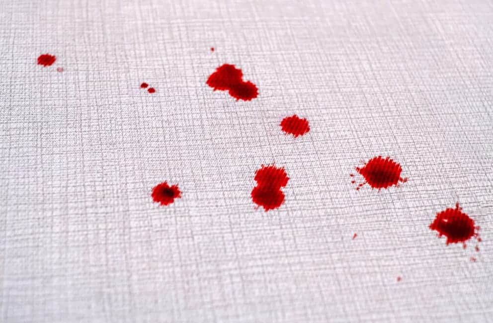 Removing Blood Stains from Your Carpet